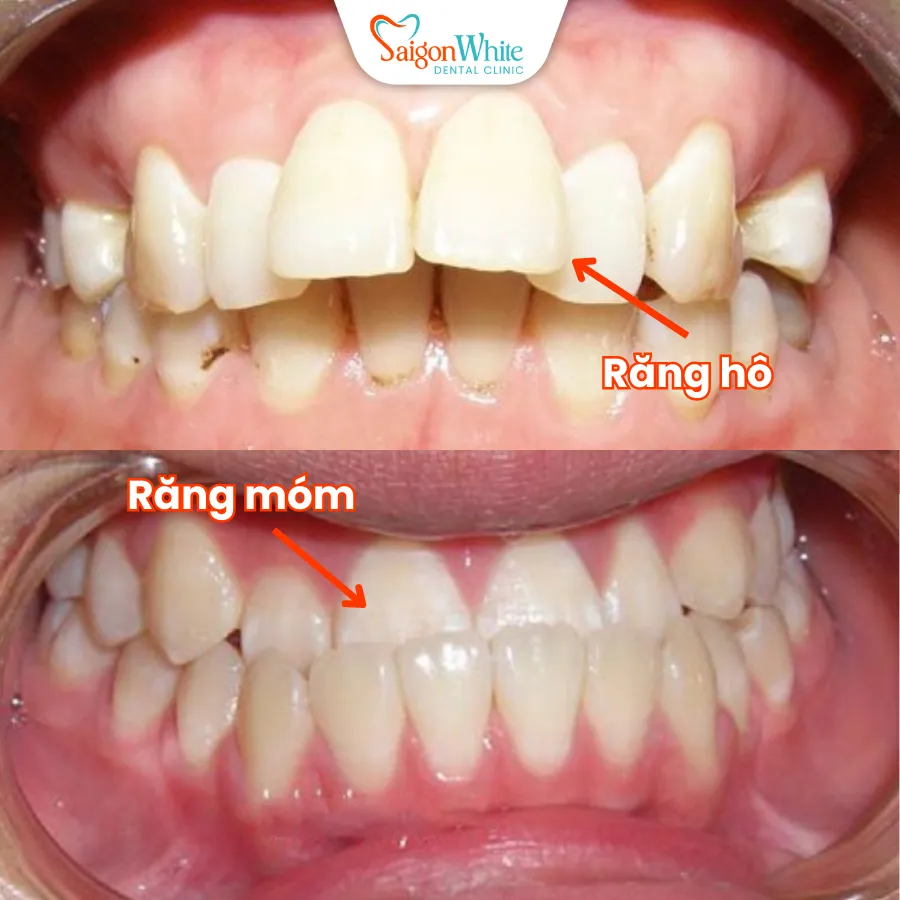 Rang ho, mom_11zon